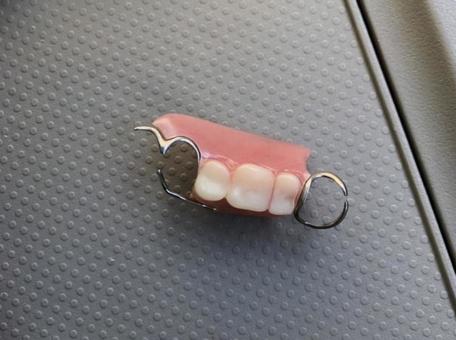 青葉台の歯医者、うかい歯科医院の歯を失った時の治療